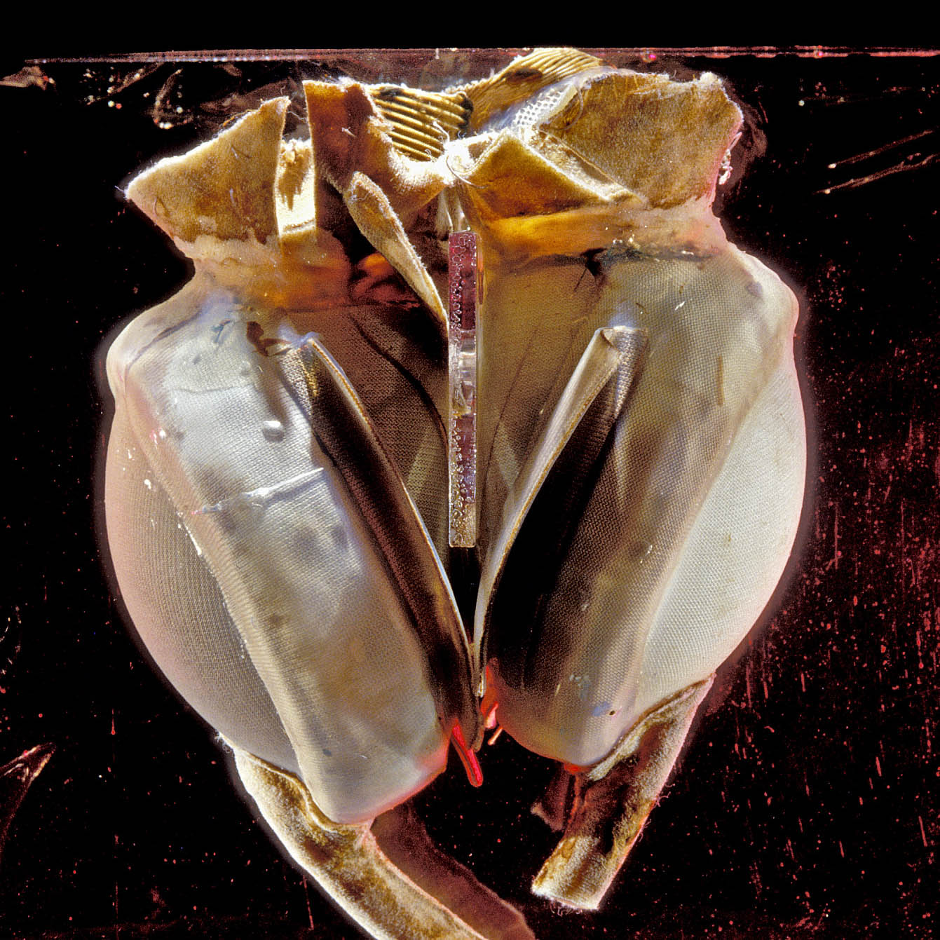 The first total artificial heart implanted in a human body
